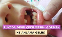 Rüyada Dişinin Sallandığını Görmek Ne Anlama Gelir? Neye İşarettir? Anlamı, Yorumu